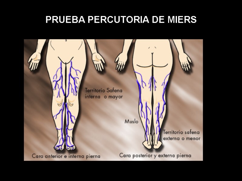 PRUEBA PERCUTORIA DE MIERS